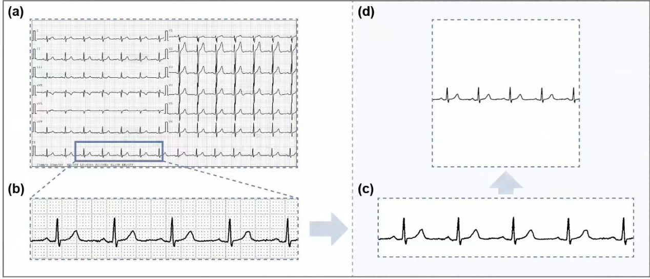 DUET: Dual-path Unified Encoder for Temporal and Spatial ECG Analysis